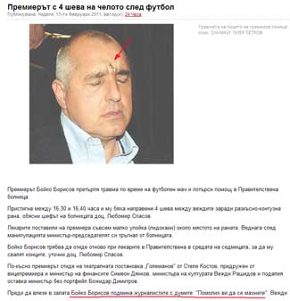 ДОКАТО КЪРПЯТ ГЛАВАТА НА Б.Б., ТЯ ИЗЯЖДА БЪДЕЩЕТО НИ
